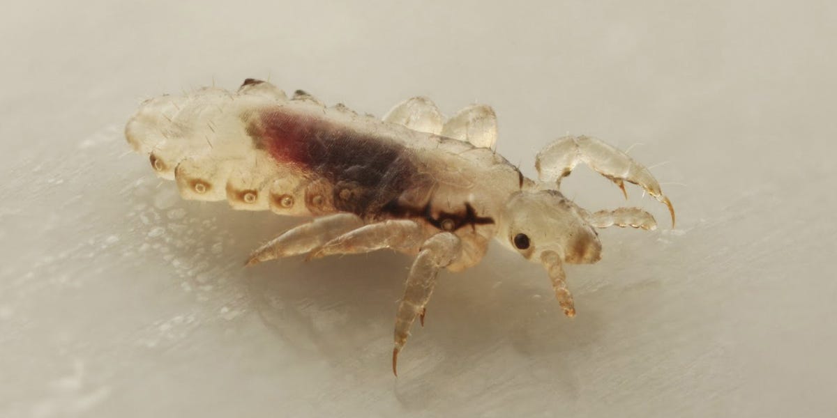 Head Lice Control