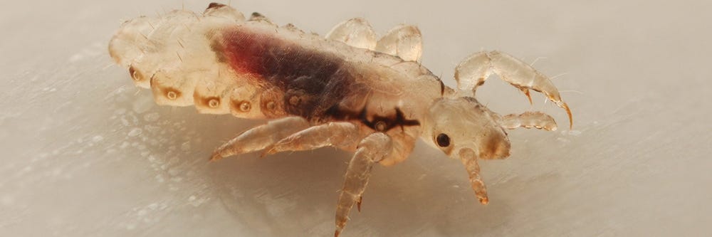 Head Lice Close Up